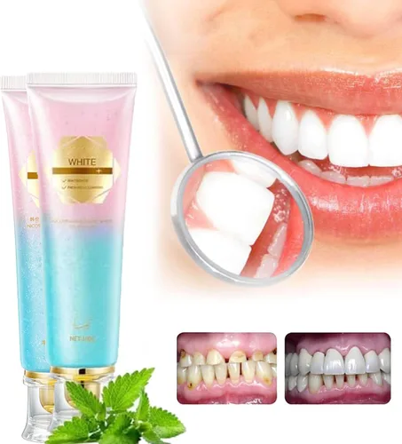 Vista 3 de Pasta de dientes blanqueadora de niacinamida, pasta de dientes blanqueadora radiante Easilyous, aliento fresco, elimina las manchas de los dientes