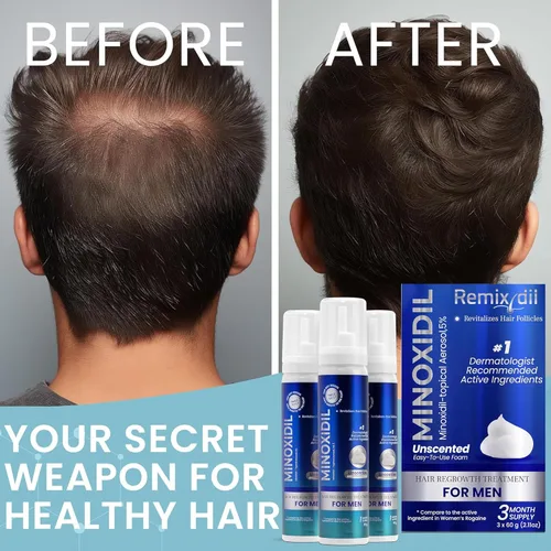 Vista 8 de Remixidil - Espuma de minoxidil al 5% para hombre Tratamiento de crecimiento capilar para hombres Fórmula clínicamente probada para la pérdida