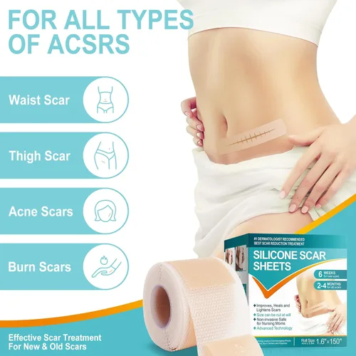 Vista 3 de Hojas de silicona para cicatrices (1.6 x 150 pulgadas - 3.8 M), cinta de silicona suave de grado médico, tiras de cicatrices, rollo de cicatrices