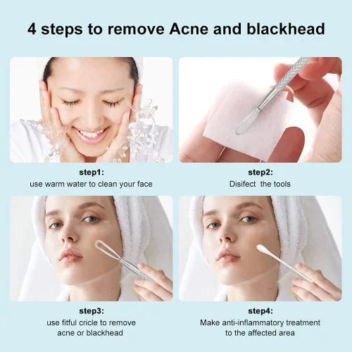 Vista 4 de Professional Blackhead and Blemish Remover -Pimple Comedone Removal 2-in-1 Extractor Tool -by La Chat (Short)