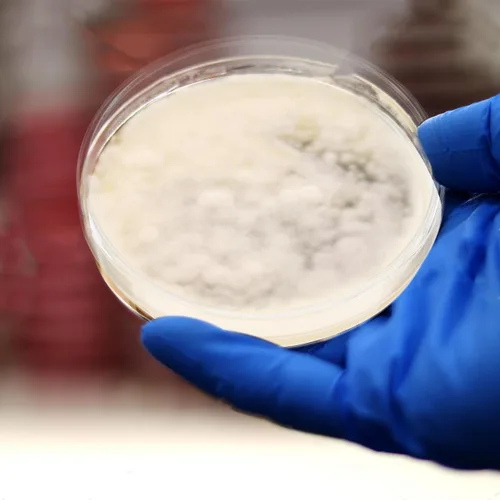 Vista 7 de ULTECHNOVO Platos de agar de dextrosa de patata, platos de agar de dextrosa prevertida PDA Petri - Excelente medio de crecimiento - Proyectos