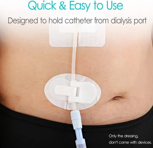 Vista 3 de Soporte de catéter PD para diálisis peritoneal, dispositivo de estabilización de parche adhesivo para línea Picc, estómago, alimentación, clavija