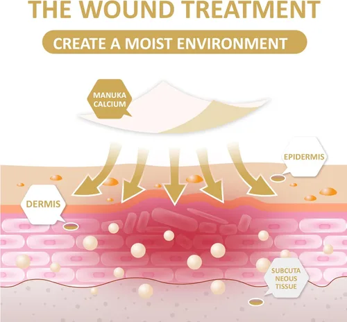 Vista 3 de Dr. Med Aderezo de alginato de calcio de miel de manuka de 2 x 2 pulgadas (10 unidades/caja), apósitos altamente absorbentes con miel