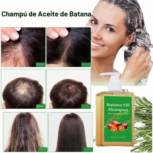 Vista 3 de ADUTRY Champú de aceite Batana, champú de aceite de romero con extracto de romero, adecuado para hombres y mujeres
