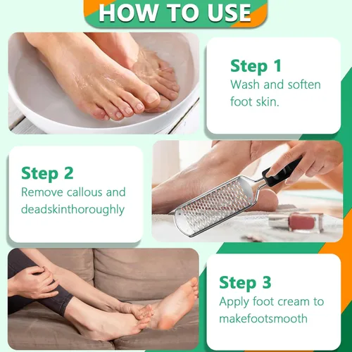 Vista 5 de Lima de pedicura profesional y removedor de callos – Material de acero inoxidable, mango ergonómico, puede quitar fácilmente la piel dura, callo