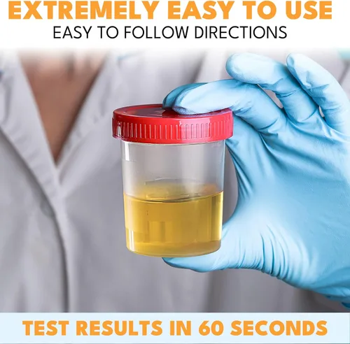 Vista 4 de 14 tiras de prueba URS para análisis de orina y detección de leucocitos y nitritos (UTI) - para uso de venta libre Leucocitos y nitritos