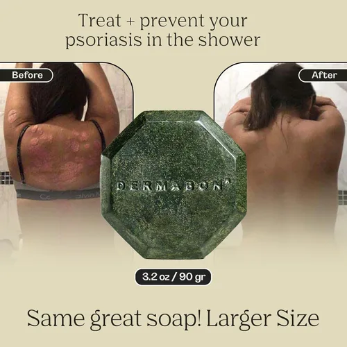 Vista 5 de Barra de jabón Dermabon para el control de la psoriasis, dermatitis y caspa con 2% de alquitrán de hulla como ingrediente activo - 1 paquete