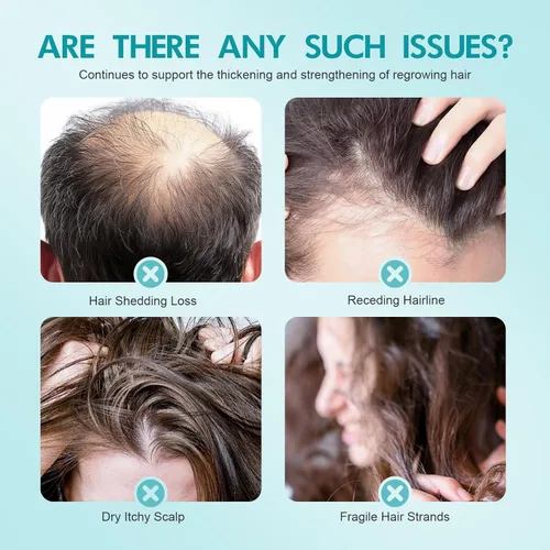 Vista 8 de Crema de masaje de cuero cabelludo de minoxidil al 5% para el crecimiento del cabello, cuidado profesional del cabello, tratamiento anti pérdida