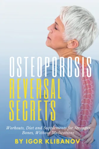 Osteoporosis Reversal Secrets Workouts, Diet and Supplements for Stronger Bones Without Medications
