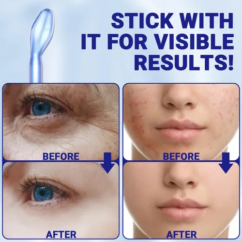 Vista 3 de Accesorio de vidrio de repuesto para varita facial (tubo de lengua)
