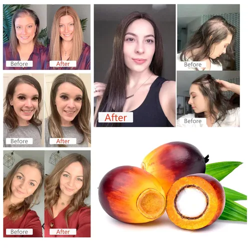 Vista 7 de Aceite de batana para el crecimiento del cabello, pestañas y cejas, aceite de batana 100% puro y natural para pérdida de cabello, reparación