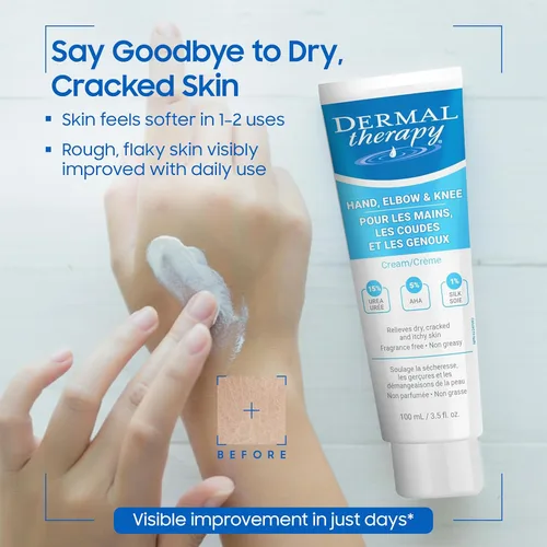 Vista 3 de Dermal Therapy Crema de manos para codos y rodillas con 15% de urea y 6% AHA, hidrata y exfolia profundamente la piel seca y agrietada en manos