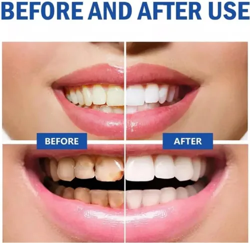 Vista 6 de SP 10 Pasta de dientes probiótica para blanquear y salud de las encías - Fórmula natural sin flúor para aliento fresco e higiene bucal