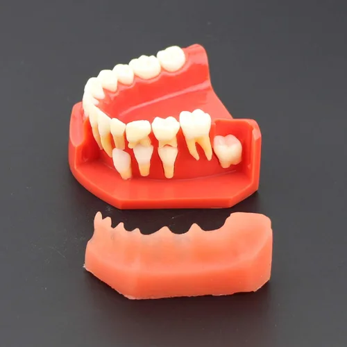 Vista 9 de Modelo de dientes dentales Typodont Desarrollo pediátrico 9-12 años Dientes Constantes crecen Reemplazar Demostración Anatomía Enseñanza Estudio