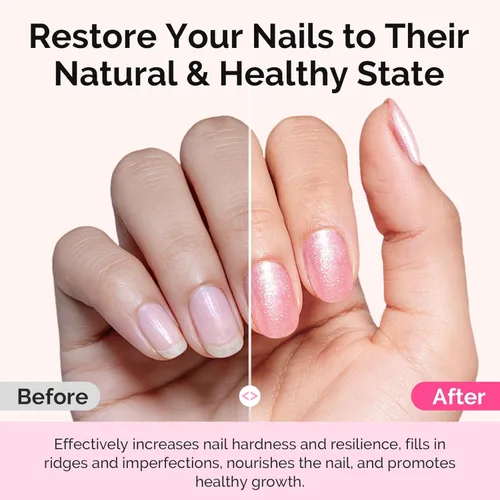 Vista 3 de MelodySusie Fortalecedor de uñas y tratamiento de crecimiento, capa base de relleno de Ridge 2 en 1 y esmalte corrector brillante para reparación