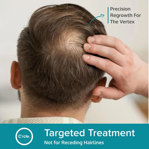 Vista 6 de Regoxidine Men's 5% Minoxidil Foam ayuda a restaurar la pérdida de cabello vértices y apoya el crecimiento del cabello con tratamiento tópico sin