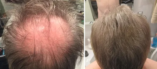 Vista 4 de Caboki Fibras regeneradoras de cabello. (30 g, suministro de 90 días). Caoba