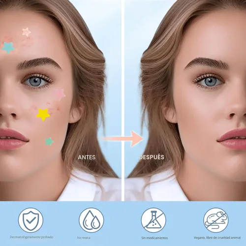 Vista 4 de Parches para espinillas para la cara, parches hidrocoloides para el acné, lindas cubiertas de espinillas con forma de estrella, pegatinas coloridas