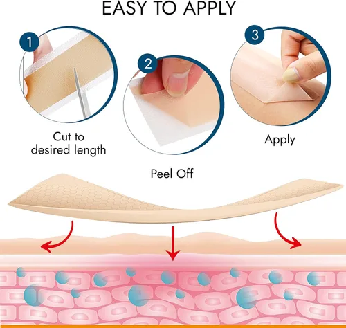 Vista 5 de Scarbandit Cinta de silicona para cicatrices – Hojas de cicatrices para eliminación de protuberancias queloides, abdominoplastia, cesárea