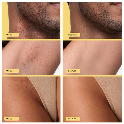 Vista 3 de Base Laboratories Tratamiento para el cabello encarnado – Suero Roller – Suero para suavizar la piel para pelos encarnados y protuberancias