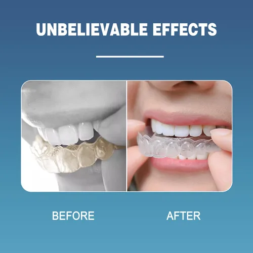 Vista 3 de EZGO Tabletas limpiadoras de retenedores, tabletas de limpieza de dentaduras para protector bucal, protector nocturno y aparatos dentales