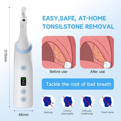 Vista 3 de Herramienta Electrónica para Eliminar Piedras de las Amígdalas con Cámara, Kit para Eliminar Piedras de las Amígdalas, 3 Niveles de Succión