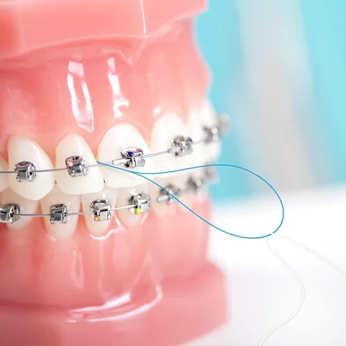 Vista 8 de Juego de enhebradores de hilo dental y hilo dental, limpieza profunda para aparatos ortopédicos, puentes e implantes, sin PFAS Sabor menta