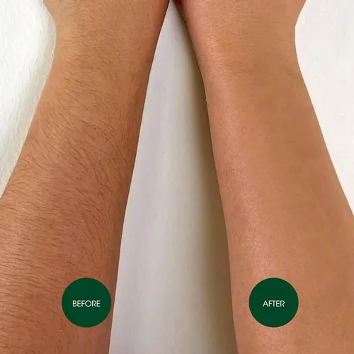 Vista 5 de Nad's gel para remover bellos sin calor, kit de 6 oz (170 g).