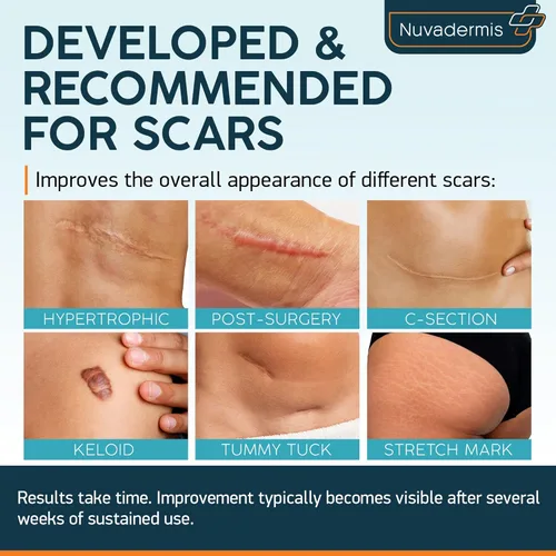 Vista 5 de Nuvadermis Paquete de hojas y cinta para cicatrices - Suministro para 60 días para un tratamiento integral de cicatrices