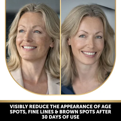 Vista 3 de VALITIC Brightening Jabón de ácido kójico de limón y cúrcuma, vitamina C, retinol, complejo japonés original con ácido hialurónico, vitamina E