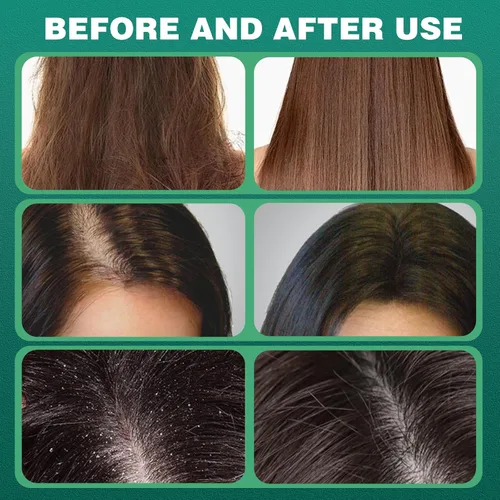 Vista 5 de 2Pcs Nature Seven Green Soap Shampoo, Nature Triangle Shampoo Bar, Polygonum Shampoos Soap, Cepress Orientalis Usman Herbal Hair Strengthening Soap