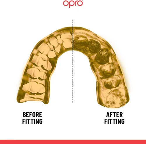 Vista 4 de OPRO Protector bucal instantáneo a medida, protector bucal para dentista, revolucionaria tecnología de ajuste para máxima comodidad, protección