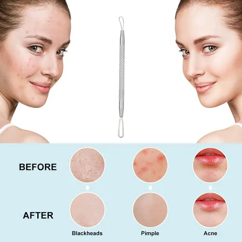 Vista 5 de Professional Blackhead and Blemish Remover -Pimple Comedone Removal 2-in-1 Extractor Tool -by La Chat (Short)