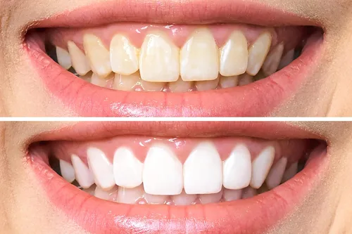 Vista 6 de Dr. George's Dental White ning Gel con instrucciones