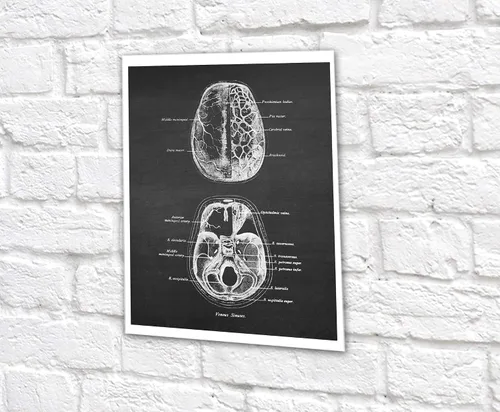 Vista 7 de Gnosis Picture Archive Neuroscience Art set de 6 impresiones sin marco de anatomía del cerebro humano
