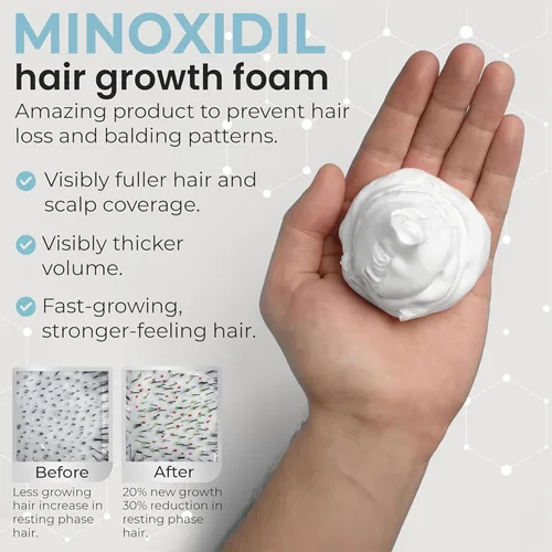 Vista 5 de Remixidil - Espuma de minoxidil al 5% para hombre Tratamiento de crecimiento capilar para hombres Fórmula clínicamente probada para la pérdida