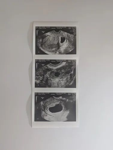 Vista 2 de Broma 2D personalizada tira de ultrasonido falso de 3 fotos