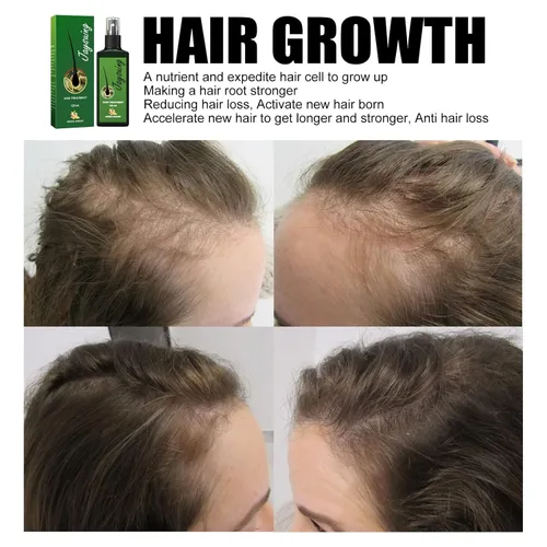 Vista 7 de 4.1 fl oz para el crecimiento del cabello aceite en aerosol tratamiento de crecimiento del cabello fortalece la pérdida de cabello dañada revitaliza
