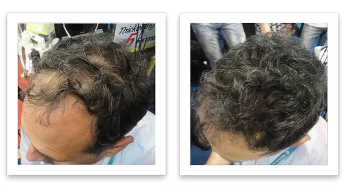 Vista 5 de Caboki Fibra de construcción de cabello + aplicador en aerosol integrado (suministro de 30-50 días). Sal y pimienta oscura