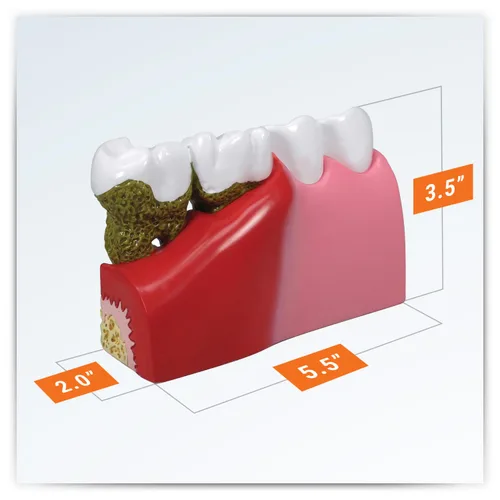 Vista 6 de GPI Anatomicals - Modelo de anatomía de dientes humanos con problemas dentales comunes, réplica para la educación en anatomía y fisiología