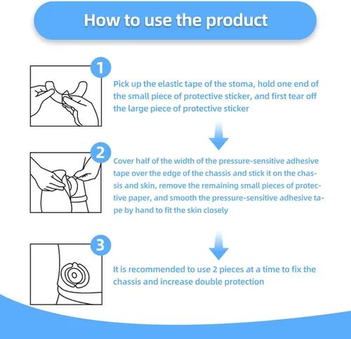 Vista 5 de Suministros de ostomía, tiras de barrera de ostomía, tiras elásticas de barrera para bolsas de colostomía, hidrocoloide de grado médico