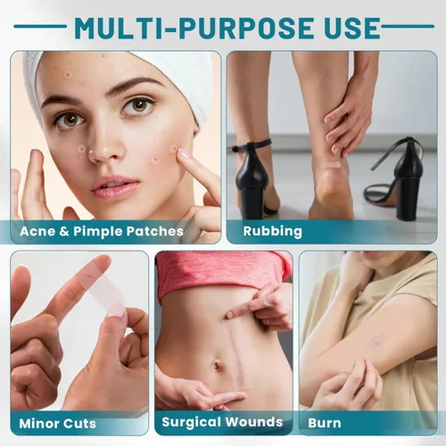 Vista 5 de WUYUAN - Parches de espinillas para cara de 0.66 x 75 pulgadas, parches grandes para acné, rollo hidrocoloide, parche para espinillas, parches