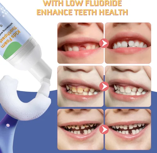 Vista 6 de Pasta de dientes de espuma para niños, 4 paquetes de pasta de dientes de espuma para cepillo de dientes eléctrico en forma de U, pasta de dientes