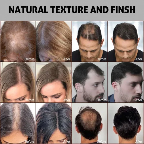 Vista 5 de Ustar Fibras de construcción del cabello para adelgazar el cabello, 0.97 oz, color gris, oculta la pérdida de cabello al instante, aspecto más