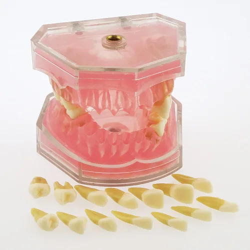 Vista 5 de Modelo de dientes de demostración dental - Estudio estándar de enseñanza dental con todos los dientes extraíbles #4004 Material de gel de sílice