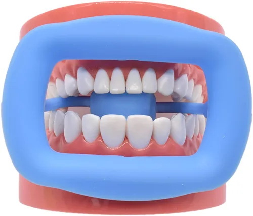 Vista 7 de Angzhili 3 piezas de abrebocas de silicona, retractor dental de mejillas para blanquear los dientes, retractor de labios intraoral reutilizable Azul