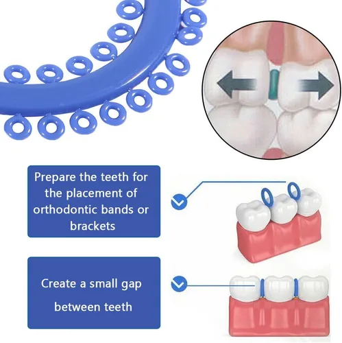 Vista 3 de Separador de ortodoncia dental, ligadura elástica de ortodoncia ligaduras de goma para dientes, sin látex (700 piezas)