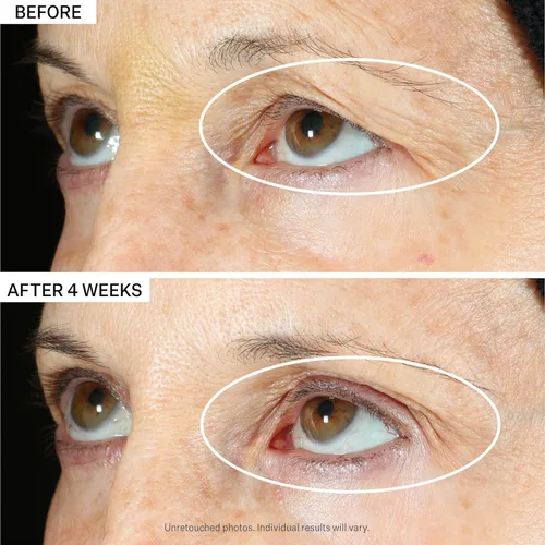 Vista 3 de StriVectin Aprieta y levanta Peptight 360 Degree Eye Serum y Tighten & Lift Advanced Neck Cream PLUS con Alpha-3 Peptides™ para cuello y escote