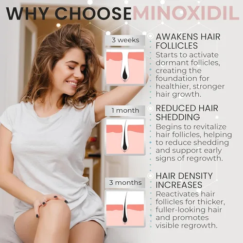 Vista 3 de Minoxidil para mujer 5% de minoxidil para el crecimiento del cabello de las mujeres Tratamiento de crecimiento del cabello Espuma tópica sin