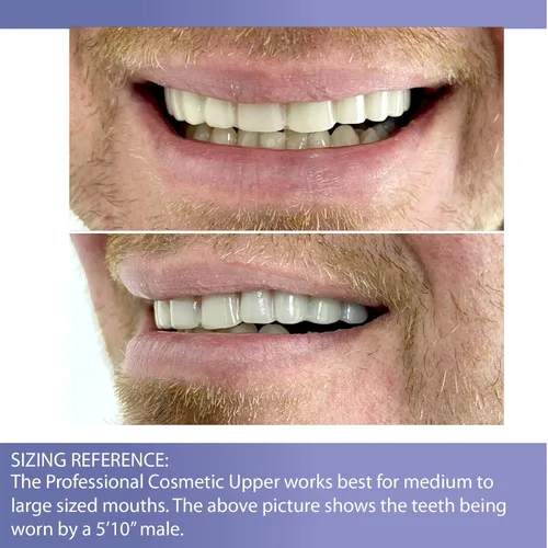 Vista 4 de Professional Cosmetic Upper - New from Instant Smile! Hand Crafted Detail, Custom fit at Home! Works Best in Medium to Large Sized Mouths.